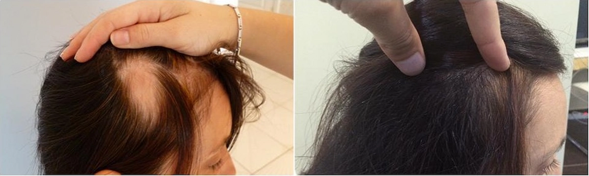 long-hair-fue