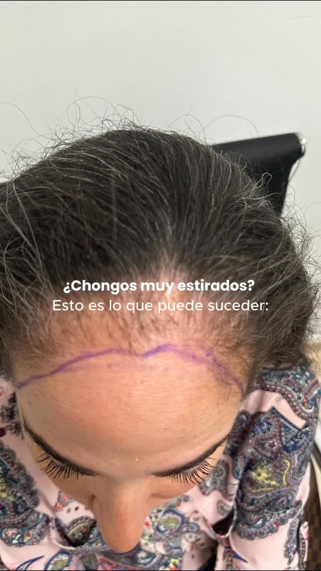 Instagram post from dr.antonioaguilar. This post is in position 1.