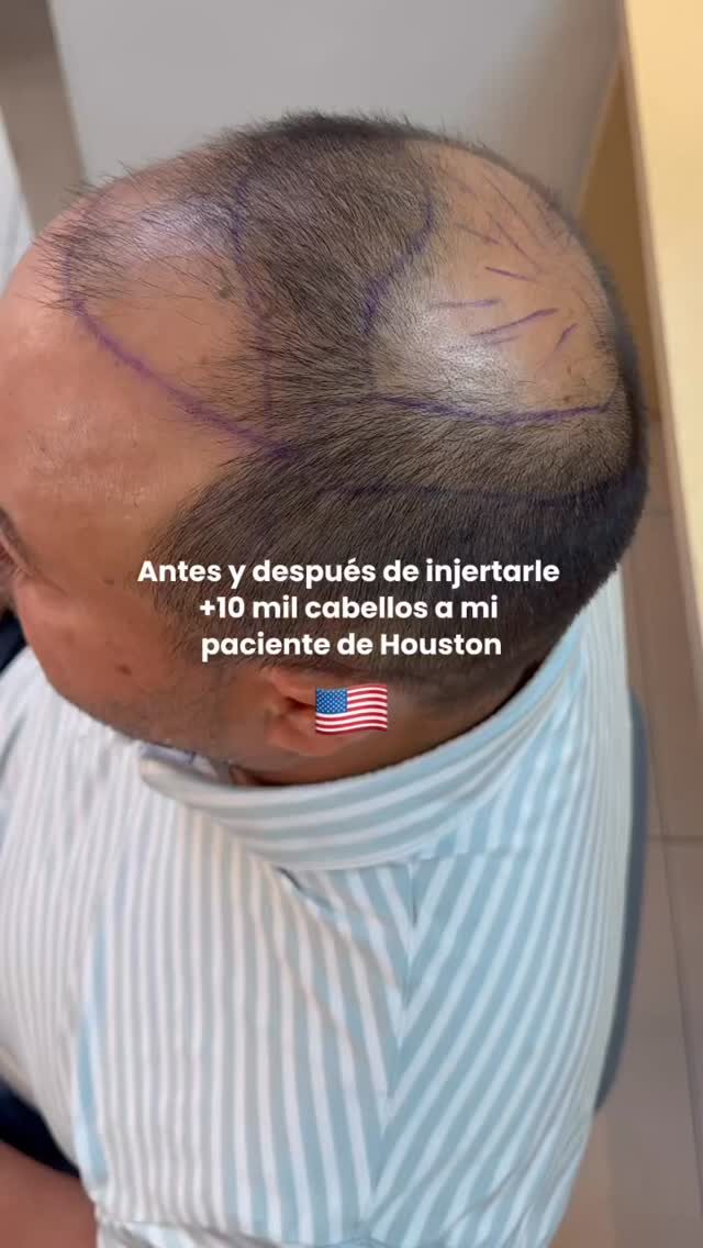 Instagram post from dr.antonioaguilar. This post is in position 3.