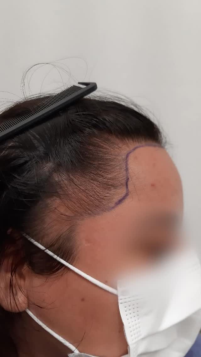 Instagram post from dr.antonioaguilar. This post is in position 2.